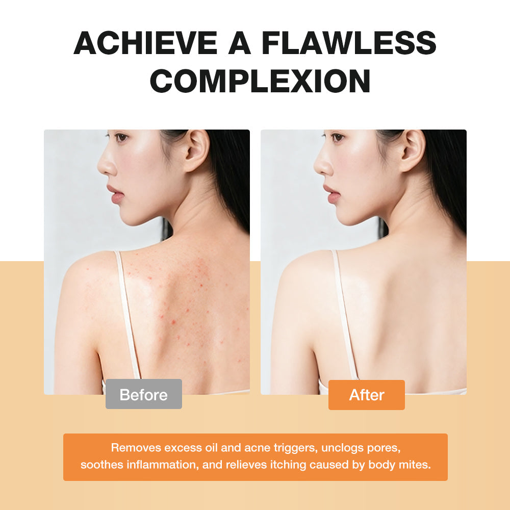 Before and after comparison of a person's back with text about achieving a flawless complexion.