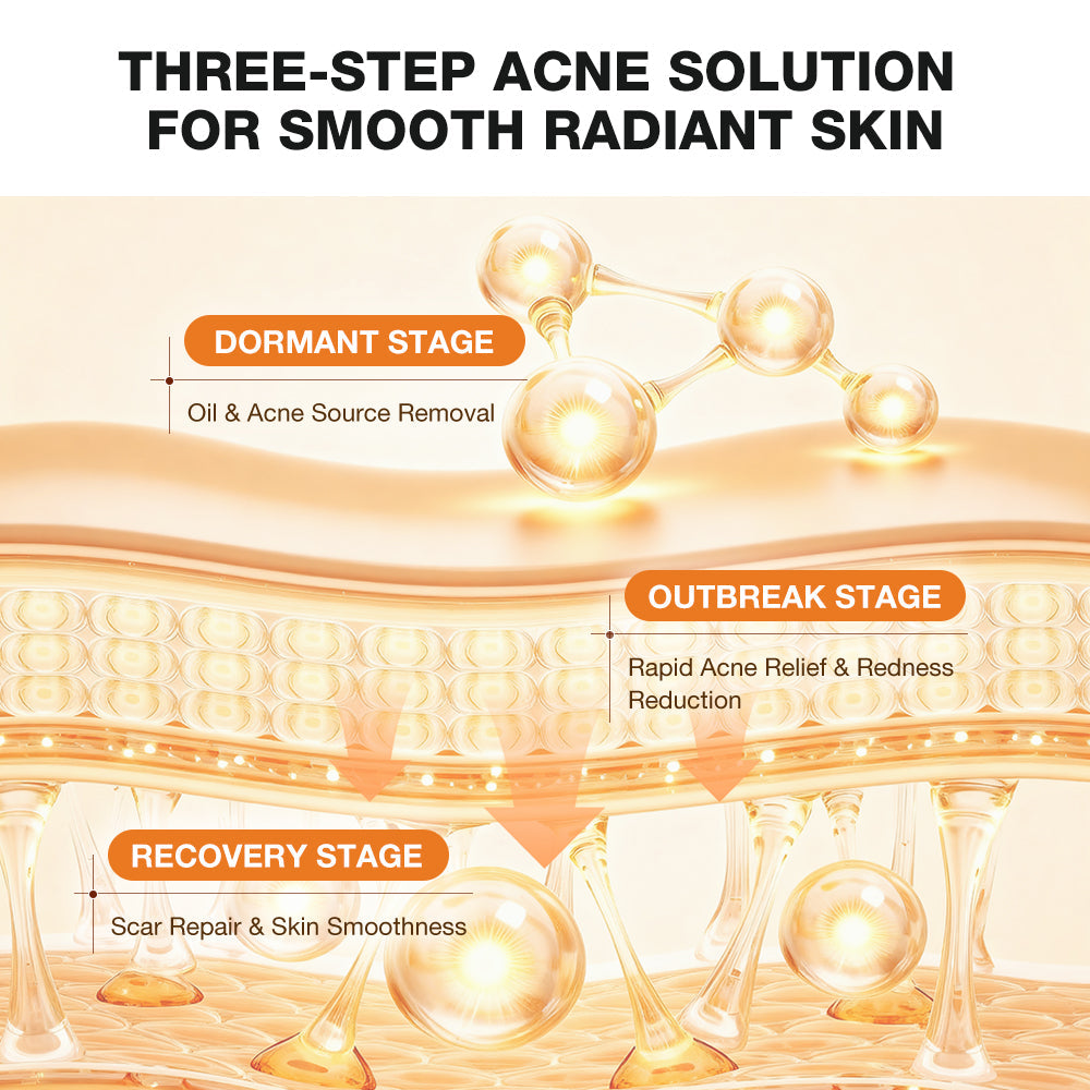 An informational graphic for a three-step acne treatment, titled 'THREE-STEP ACNE SOLUTION FOR SMOOTH RADIANT SKIN.' The design shows a stylized skin layer diagram with glowing golden molecular structures above it and three labeled stages: Dormant Stage, Outbreak Stage, and Recovery Stage, with text describing oil and acne source removal, rapid acne relief and redness reduction, and scar repair and skin smoothness.