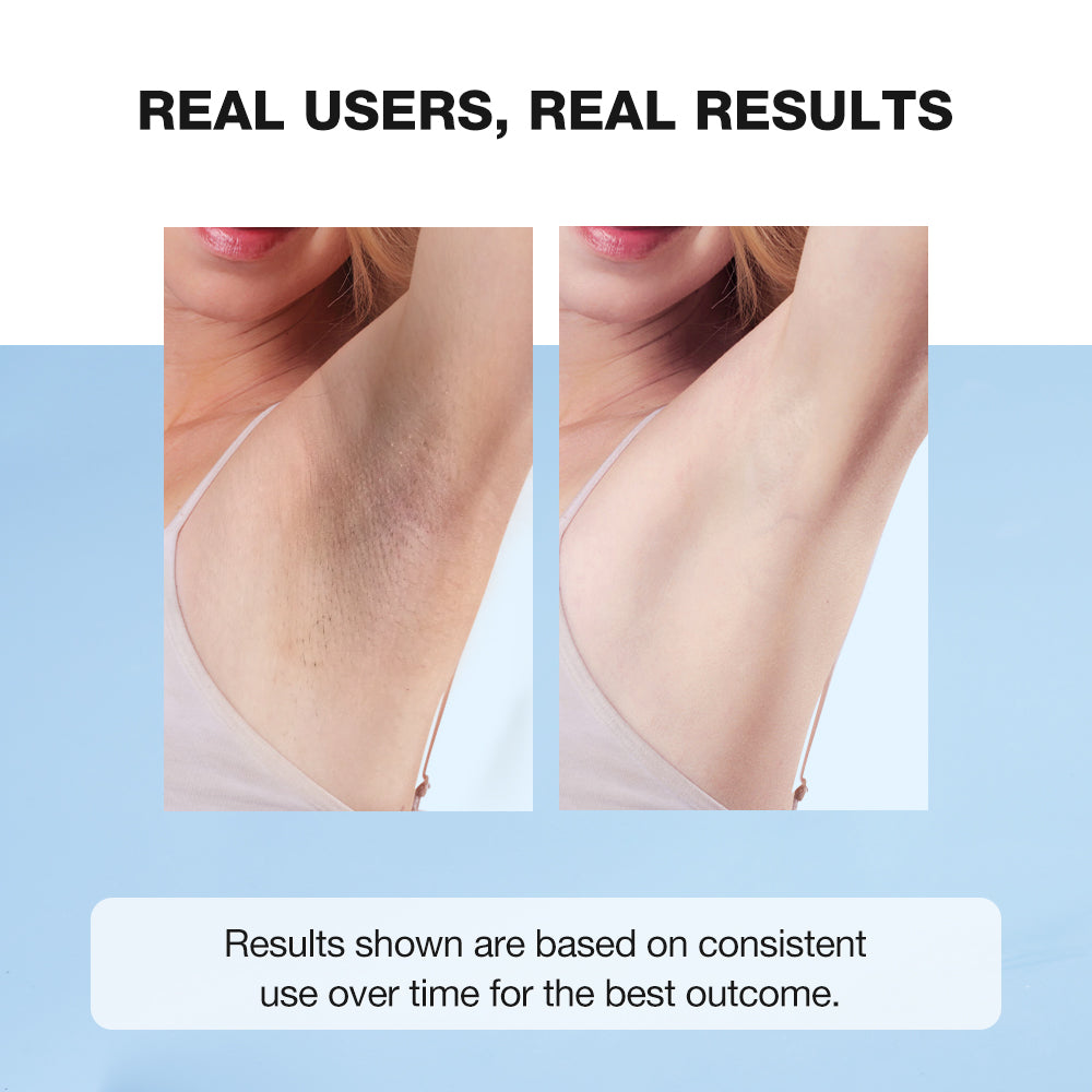 Before and after comparison of armpit hair reduction with text 'Real Users, Real Results'.