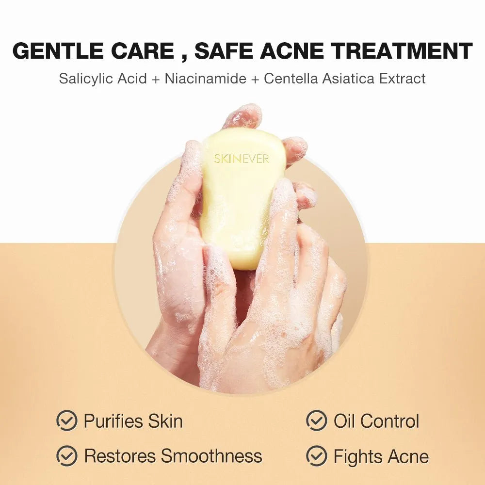 Hand holding a Skinever skincare product with text about gentle care and safe acne treatment.