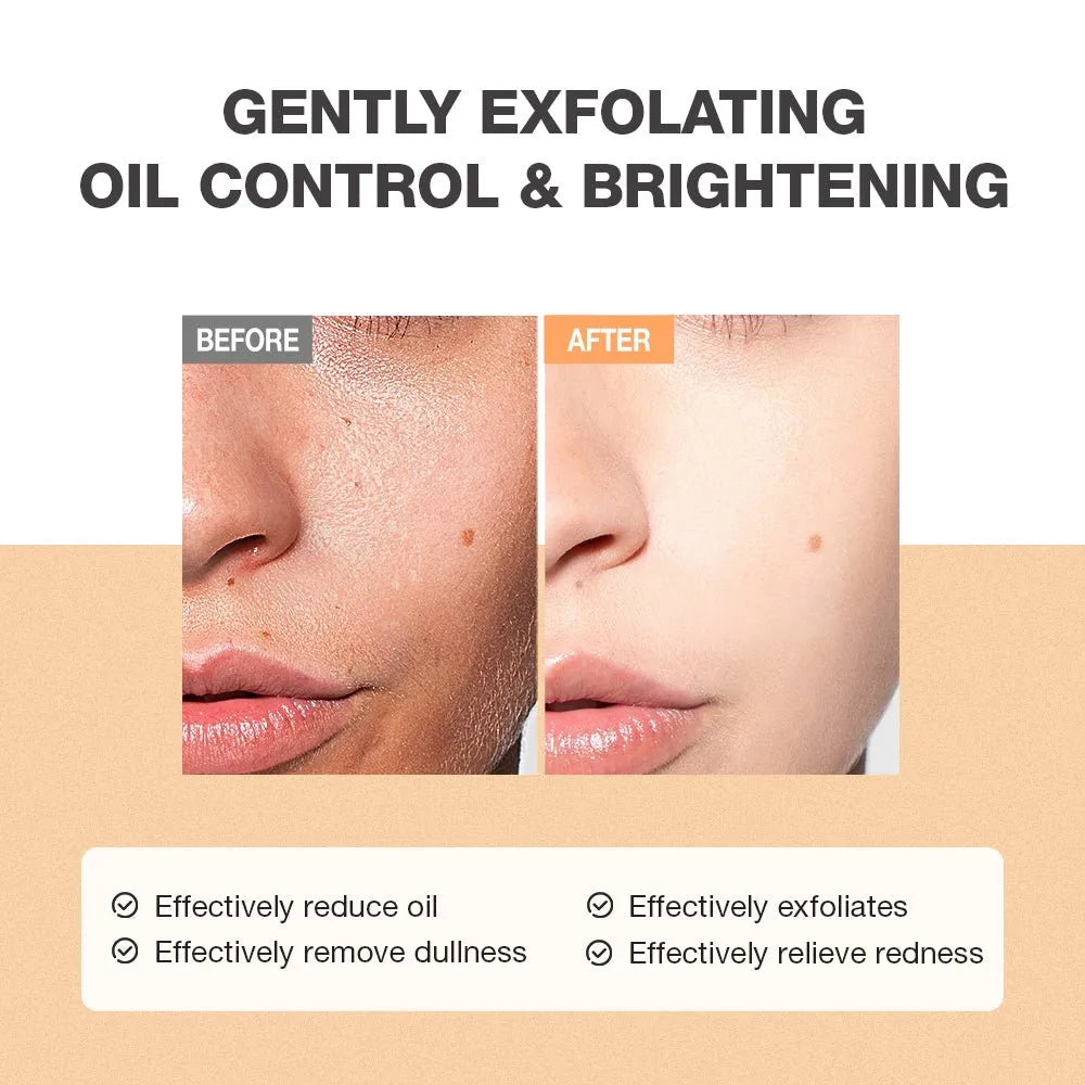 Before and after comparison of skin exfoliation with text highlighting benefits.
